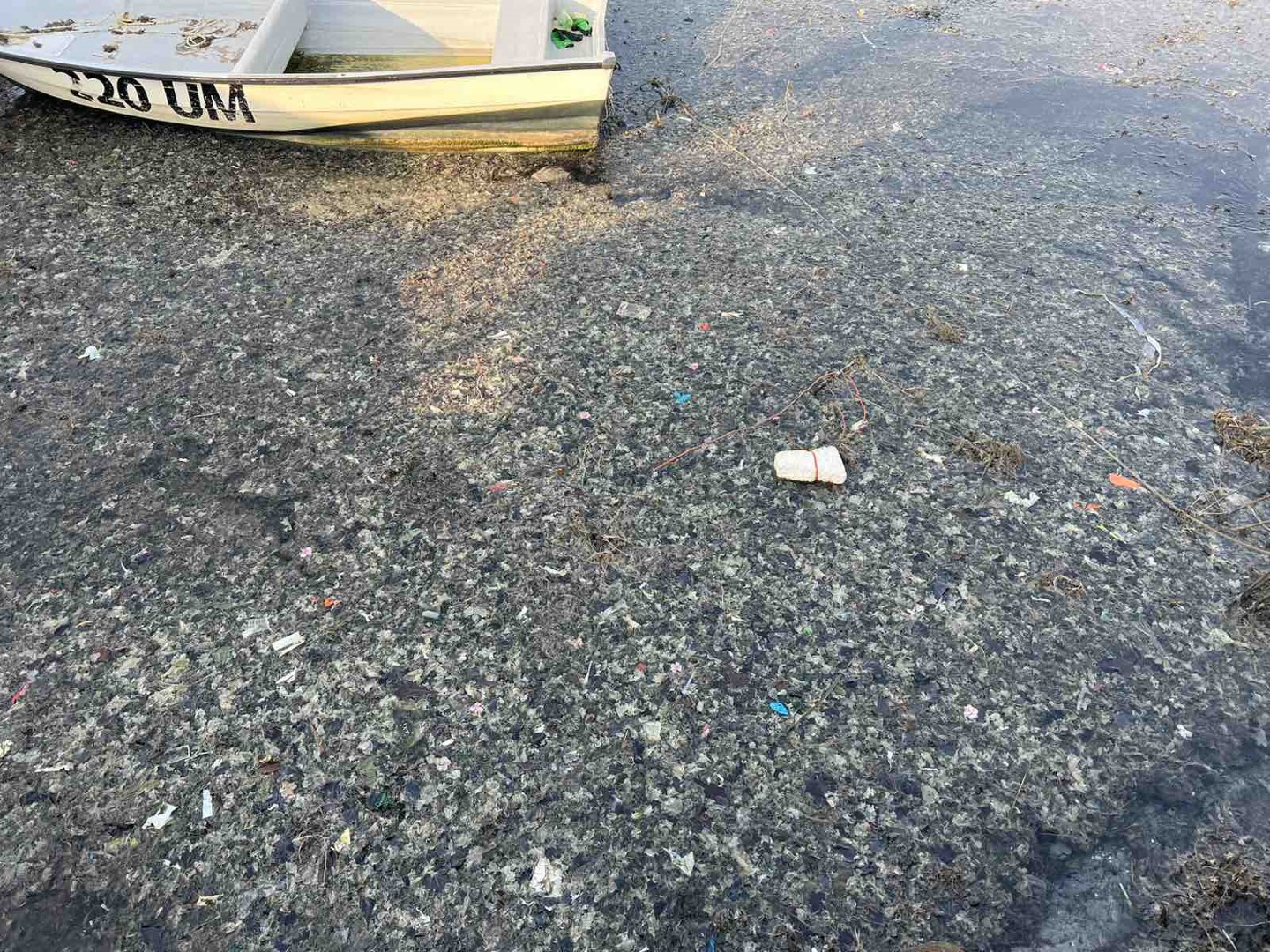  Kad ono fekalije postanu govna